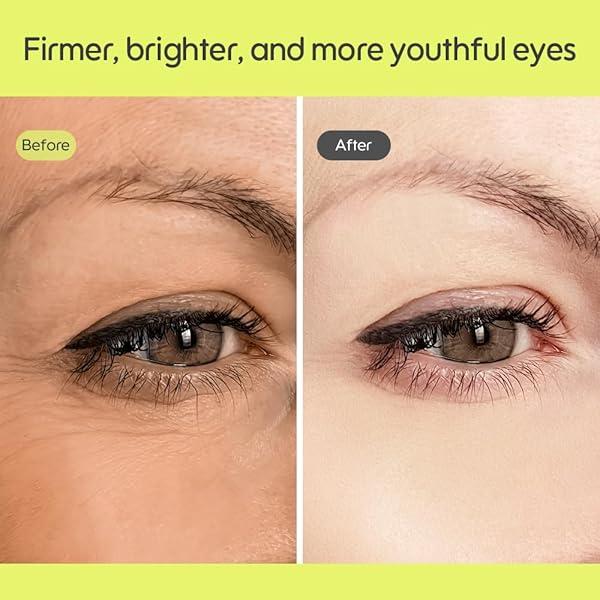 Kiero Pure Radient Eye Cream 25Ml / 0.85Fl.Oz.